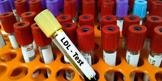 Those who were on a keto-like diet were found to have markedly higher levels of LDL (