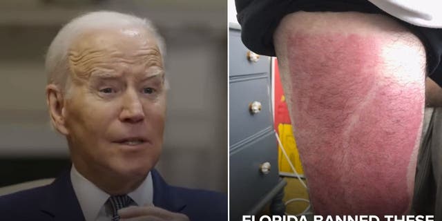 Florida Gov. Ron DeSantis released a video Tuesday showing the graphic results of multiple transgender surgeries after President Biden called the Republican’s policies "cruel."