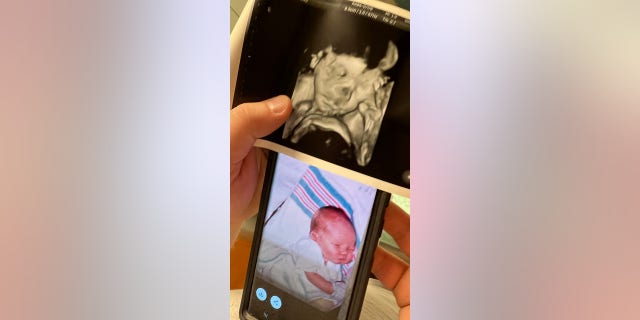 Haylee and Shawn Ladner were shocked when their doctor told them during their ultrasound that he found five heartbeats.