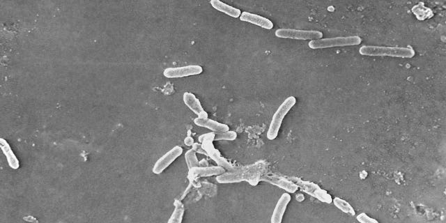 Rod-shaped Pseudomonas aeruginosa bacteria is scanned under a microsope. Pseudomonas aeruginosa is commonly linked to outbreaks in Indian hospitals