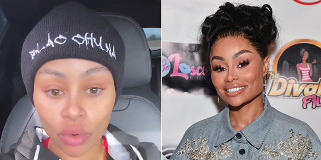 Blac Chyna said she has dissolved all the filler in her face. The left image is her after filler was removed. The right is before the procedure.