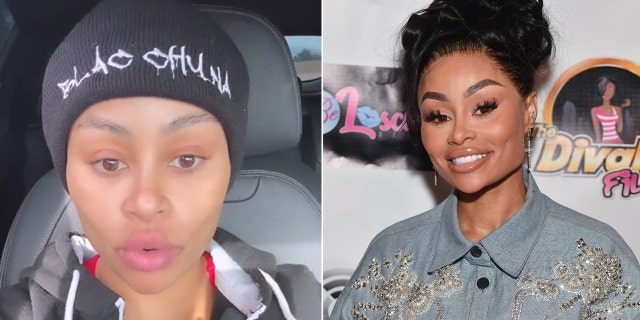 Blac Chyna said she has dissolved all the filler in her face. The left image is her after filler was removed. The right is before the procedure.