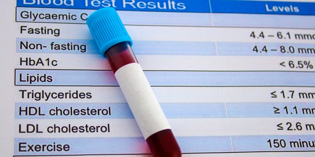 Blood is made up of red blood cells, white blood cells and platelets that float in the liquid part of the blood known as plasma.  When we bleed, this initiates coagulation - or a clotting cascade - which activates platelet proteins that stick together to fill the hole in the blood vessel so that we stop bleeding. 