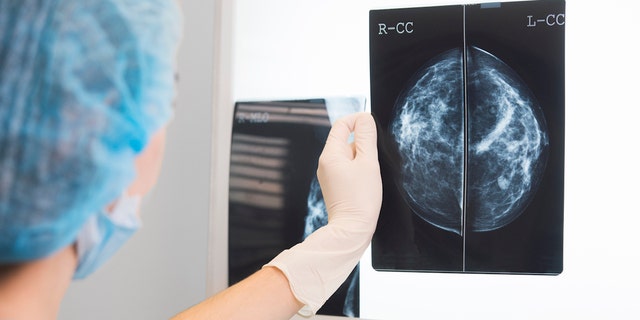 Aside from skin cancers, breast cancer is the most common type of cancer among U.S. women, accounting for some 30% of all new female cases yearly.
