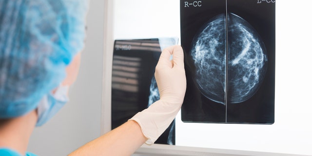 Aside from skin cancers, breast cancer is the most common type of cancer among U.S. women, accounting for some 30% of all new female cases yearly.