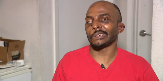 Terrence Marshall was attacked by five of his neighbor's pit bulls when he was outside his apartment last month.