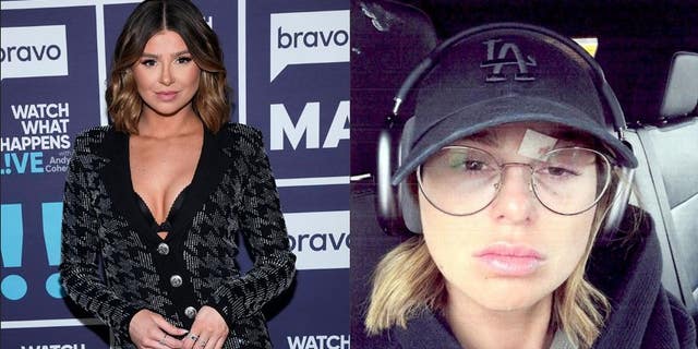 Raquel Leviss revealed cuts and bruises on her face in a temporary restraining order filing against ‘Vanderpump Rules’ co-star Scheana Shay.