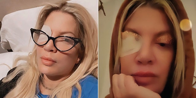 Tori Spelling revealed she had an ulcer on her eye with a post on social media.