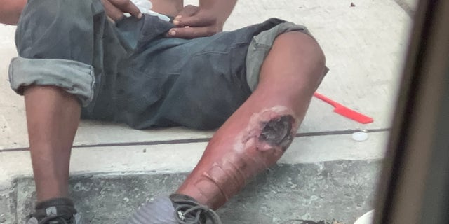 Ein freigelegtes Bein zeigt eine Betäubungswunde