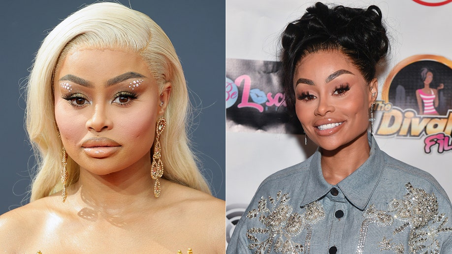 Blac Chyna before and after removing face fillers