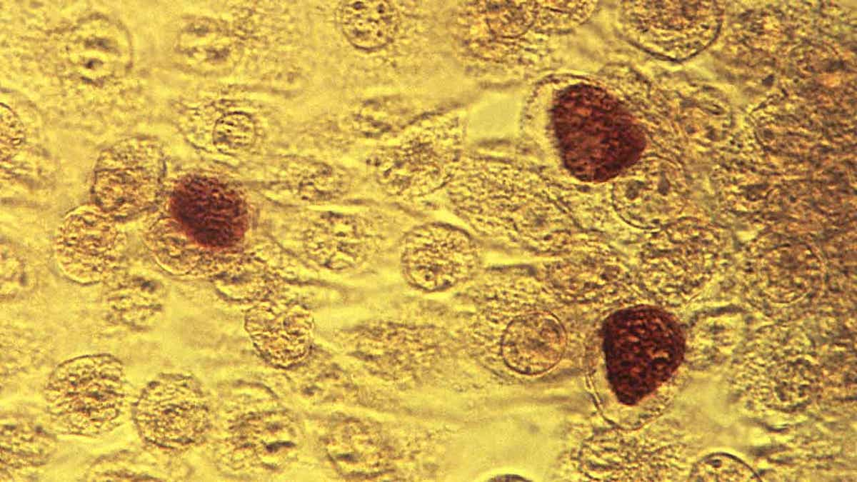 Microscopic image of chlamydia