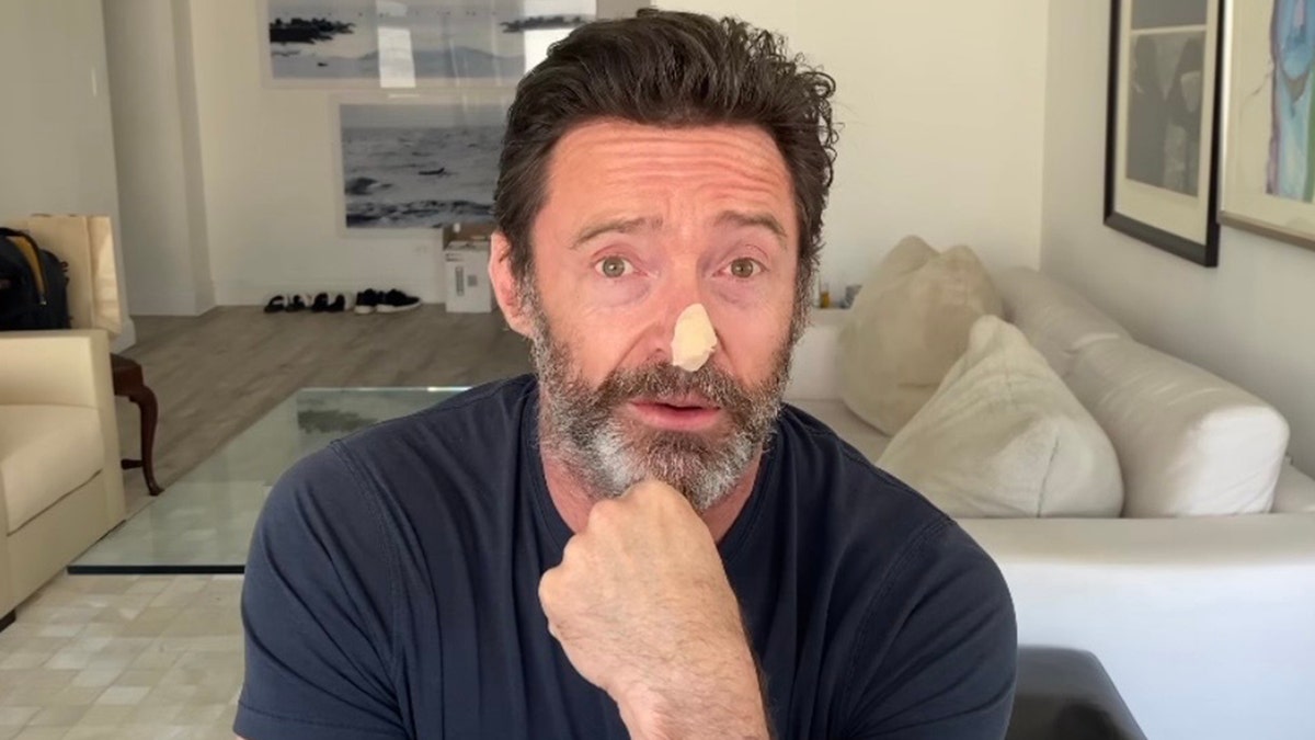 Hugh Jackman in a navy t-shirt and a bandage on his nose speaks to the camera, resting his hand on his chin