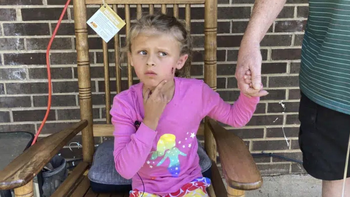 Kinsley White, 6, points to a wound on her cheek.