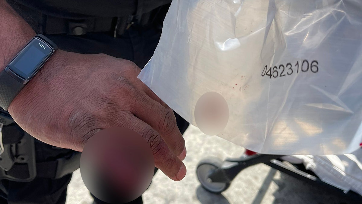 LAPD cop loses part of finger