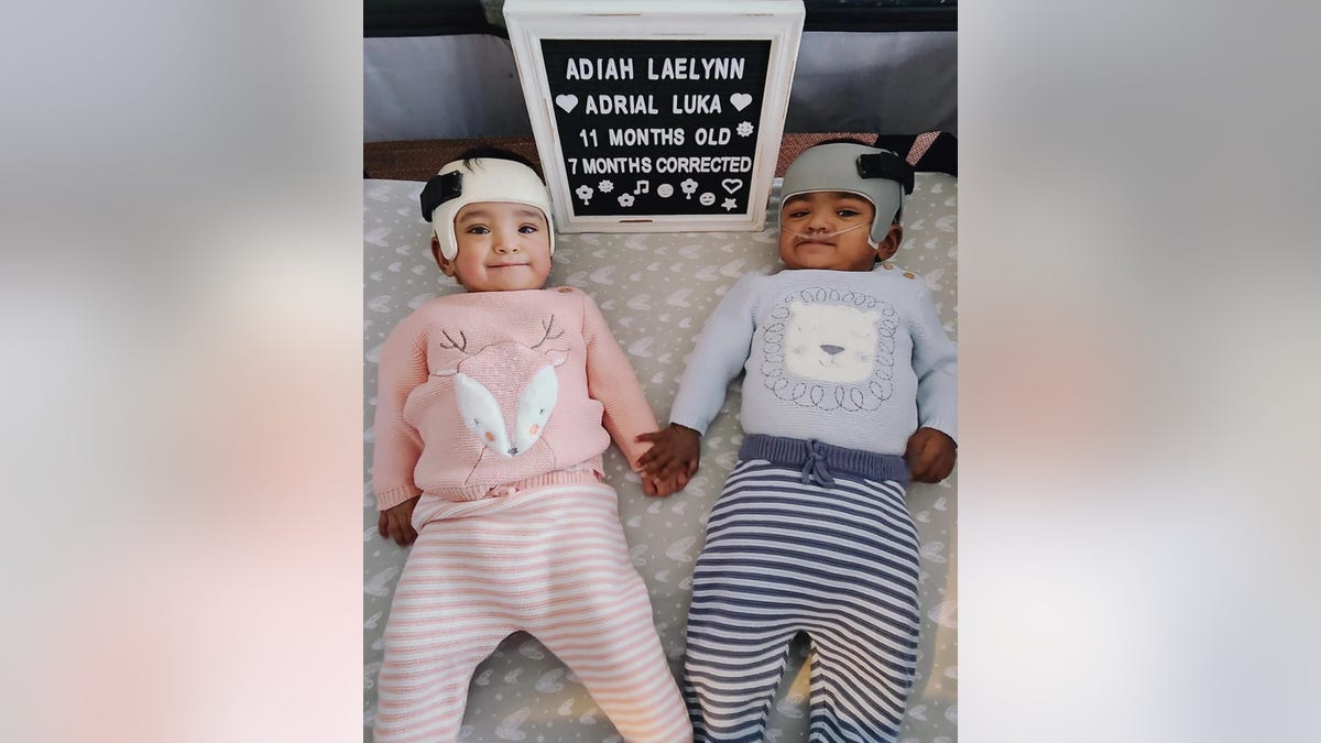 photo of record-breaking premature twins