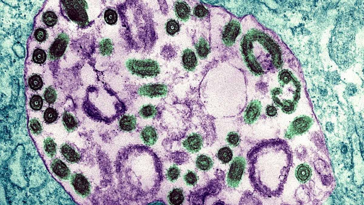 Close-up of Marburg virus