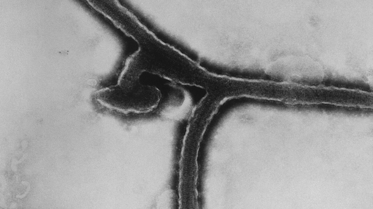 TEM of Marburg virus