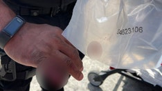 Los Angeles police officer loses part of finger bitten off by homeless man, LAPD says