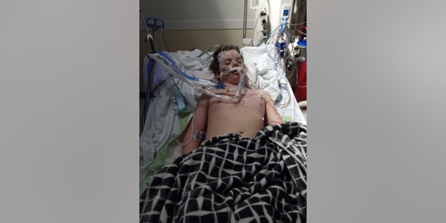 Jacob Stevens, 13, spent six days hospitalized with no brain activity after partaking in the "Benadryl challenge" on TikTok before his family decided to take him off life support.