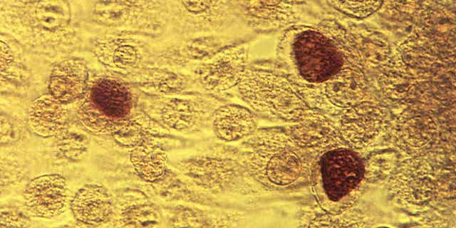This 1975 microscope image made available by the Centers for Disease Control and Prevention shows Chlamydia trachomatis bacteria. Health officials released data on April 11, 2023, showing how chlamydia, gonorrhea, and syphilis cases have been accelerating, but doctors are hoping an old drug will help fight the sexually transmitted infections. 