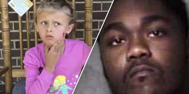 Kinskey White pointing to an injury on her left cheek and a booking photo of Robert Singletary.