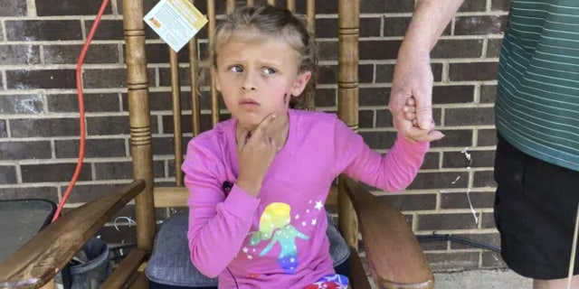 Kinsley White, 6, points to a wound on her cheek.