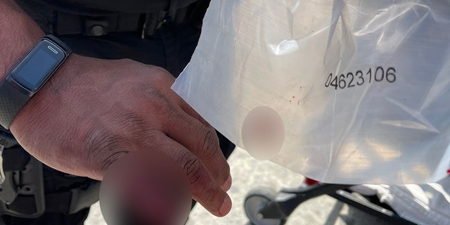 LAPD cop loses part of finger