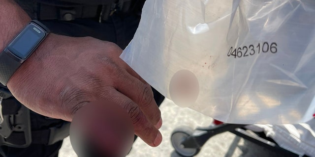LAPD cop loses part of finger