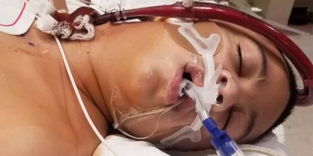 Zachary Corona, 13, shown in the hospital after a group of bullies allegedly pressured him to smoke a fentanyl-laced vape.