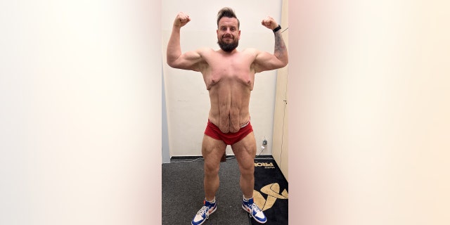 Weight loss