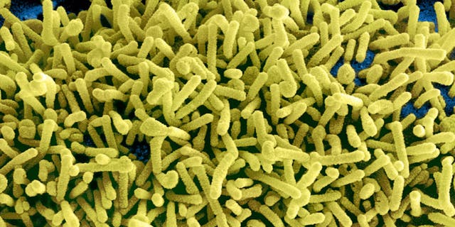 Due to the Marburg virus' similarity to the Ebola virus, the CDC recommends that doctors follow the same protocols for infection prevention and control when dealing with cases (enlarged particles of the Marburg virus pictured).