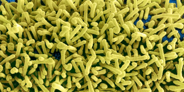 Due to the Marburg virus' similarity to the Ebola virus, the CDC recommends that doctors follow the same protocols for infection prevention and control when dealing with cases (enlarged particles of the Marburg virus pictured).