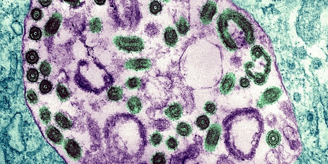 Electron Micrograph Of The Marburg Virus. Marburg Virus, First Recognized In 1967, Causes A Sever Type Of Hemorrhagic Fever, Which Affects Humans, As Well As Non Human Primates.