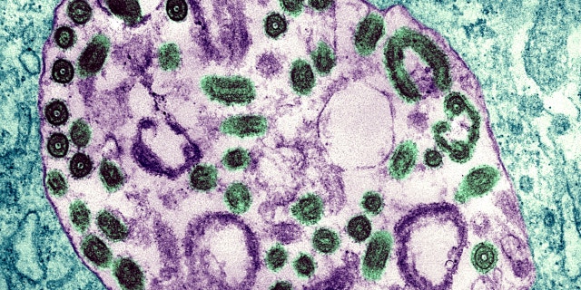 Electron Micrograph Of The Marburg Virus. Marburg Virus, First Recognized In 1967, Causes A Sever Type Of Hemorrhagic Fever, Which Affects Humans, As Well As Non Human Primates.