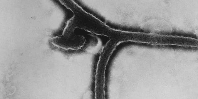 This transmission electron micrograph (TEM) revealed some of the ultrastructural morphology exhibited by the Marburg virus, the cause of Marburg hemorrhagic fever. 