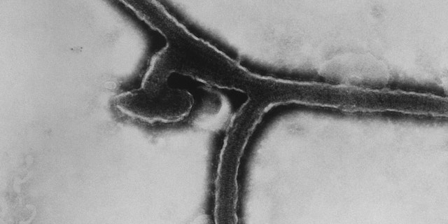 This transmission electron micrograph (TEM) revealed some of the ultrastructural morphology exhibited by the Marburg virus, the cause of Marburg hemorrhagic fever. 