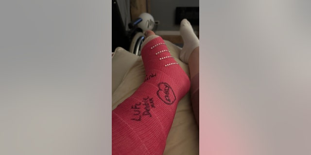 The fracture in her foot was caused by the hole from the rip in her dress created earlier that day, Daisy Allen said about her wedding-day traumas.