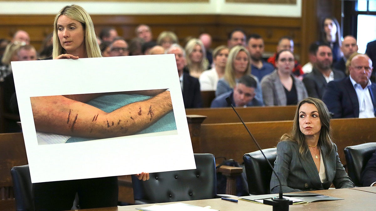 Karen Read looks at image of Kohn O'Keefe injuries