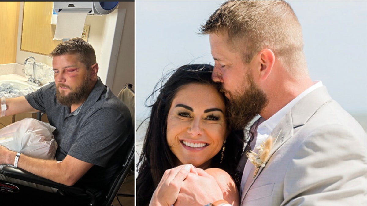 Aric Hutchinson in the hospital next to a photo of the couple on their wedding day.