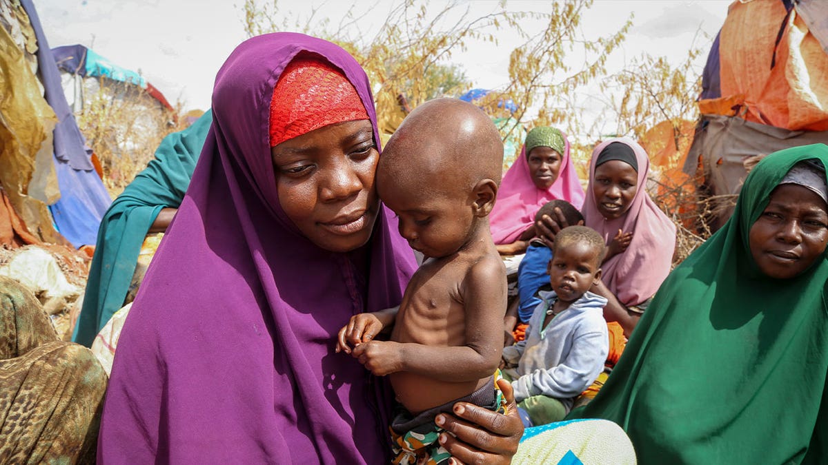 mother and malnourished child