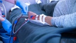 A nurse with blue protective gloves is preparing a patient for hemodialysis