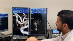 Reports reveal the risk for strokes is on the rise in young adults