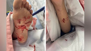 Pennsylvania teenager surfing in New Jersey suffers injuries from possible shark attack: reports