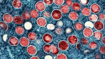 Study suggests dozens of US cities are at risk for mpox outbreaks this summer
