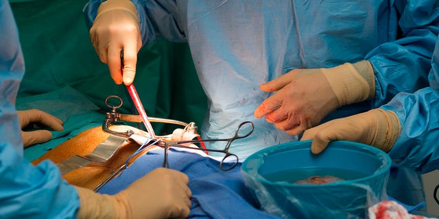 kidney transplant doctors