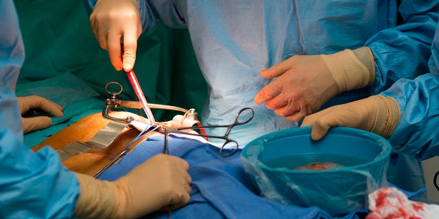 kidney transplant doctors