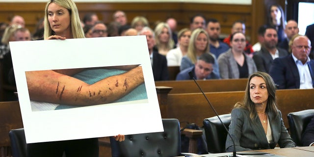 Karen Read looks at image of Kohn O'Keefe injuries