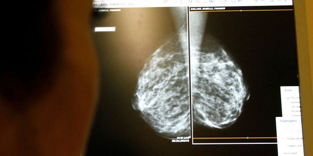 Breast cancer screening images