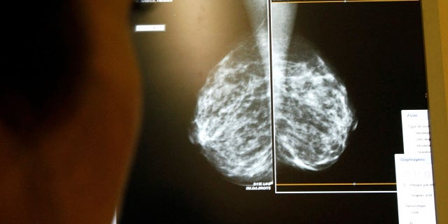 breast cancer screening images