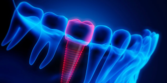 تكنولوجيا طب الأسنان